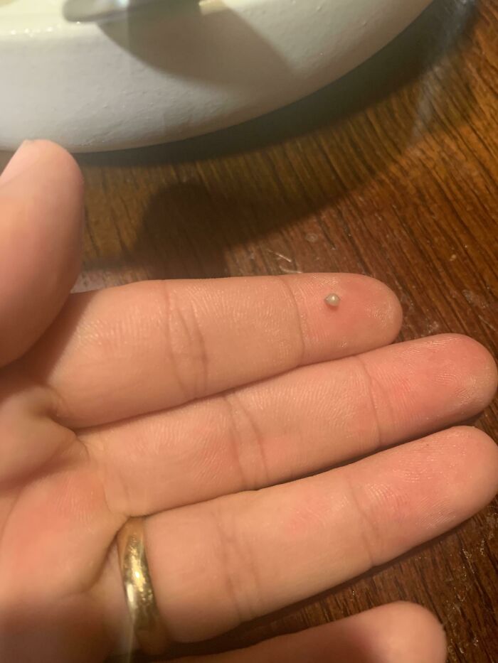 Made Mussels Tonight, And When My Wife Bit Into One She Found A Tiny Pearl