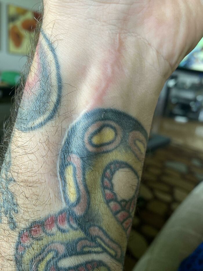 Wrist Surgery. My Surgeon Incised Around My Tattoo. He Could Have Not Cared And Cut Right Through It. Pretty Bro Move If You Ask Me