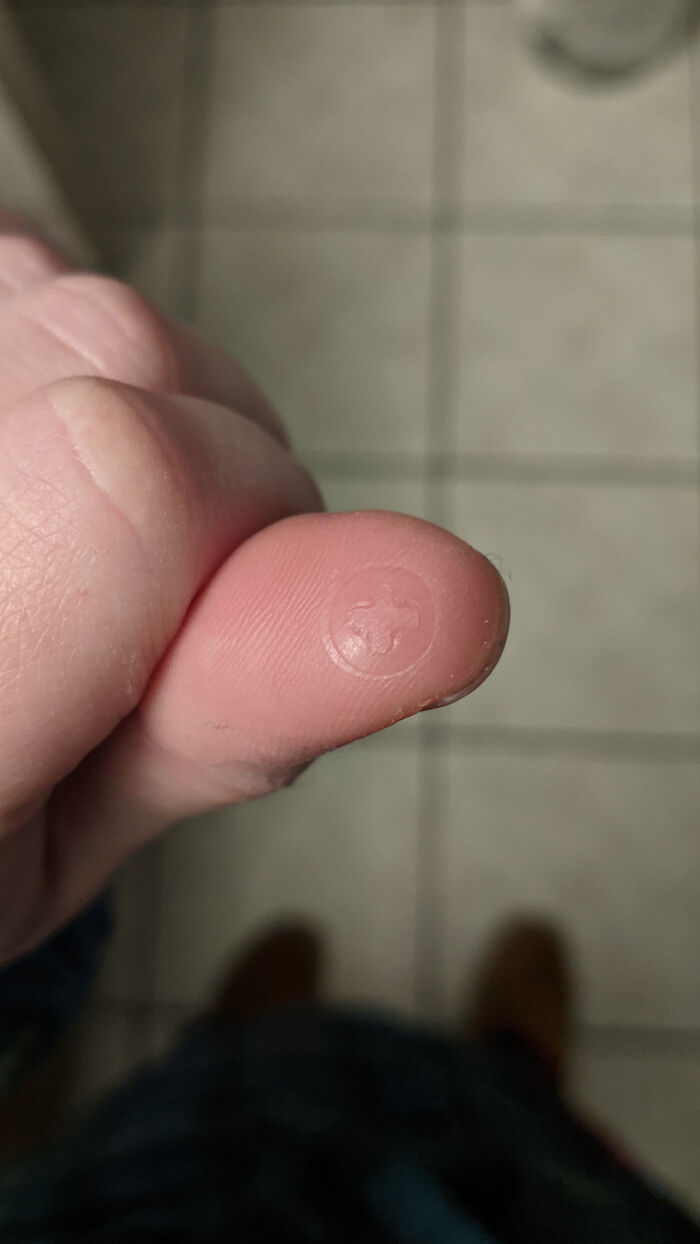 Accidentally Burned My Thumb On A Hot Screw