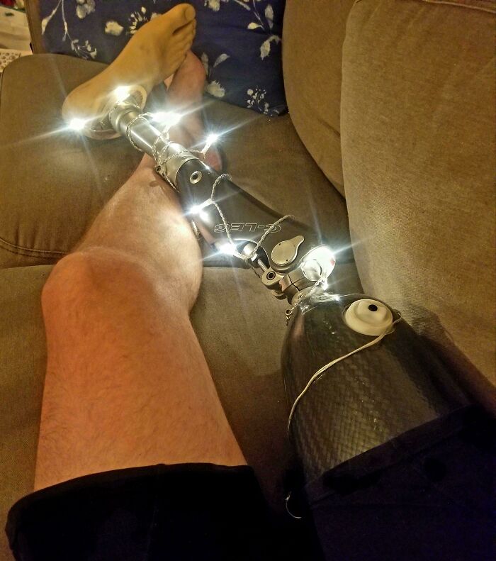 My Sister Thought My Leg Could Use More Holiday Spirit