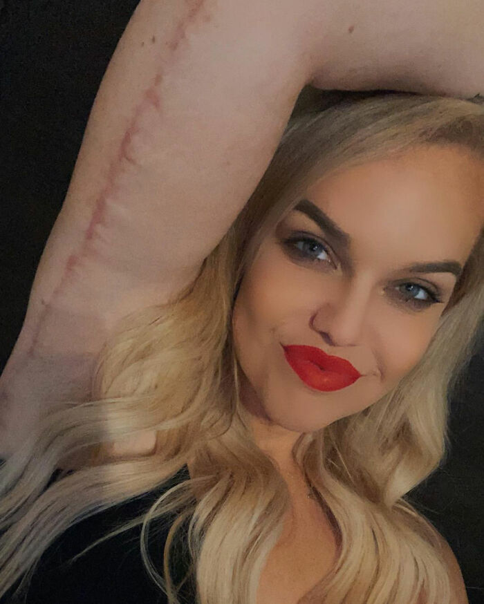 Woman's Ex-Boyfriend Didn't Introduce Her To His Parents Because Of Her Weight, She Lost 200 Lbs To Get Revenge Woman's Ex-Boyfriend Didn't Introduce Her To His Parents Because Of Her Weight, She Lost 200 Lbs To Get Revenge