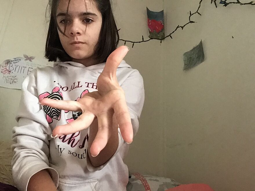 I Can Dislocate My Thumb