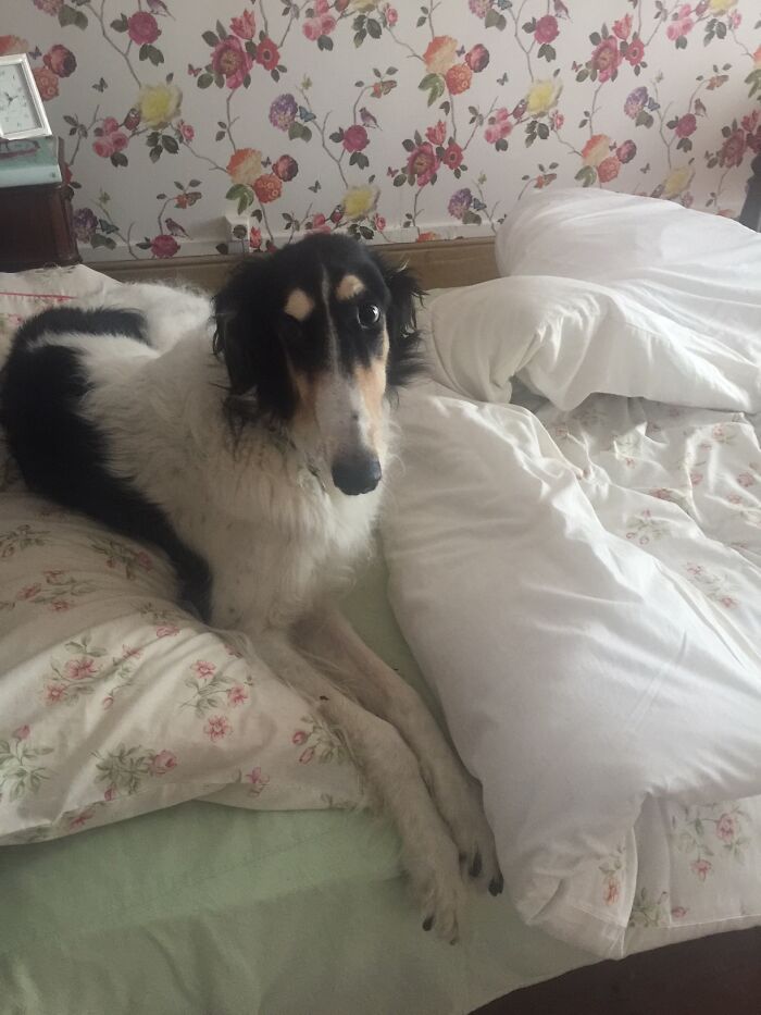 Mum Thinks She Is Getting Bald......so Much Hair On Her Pillow.....hahaha