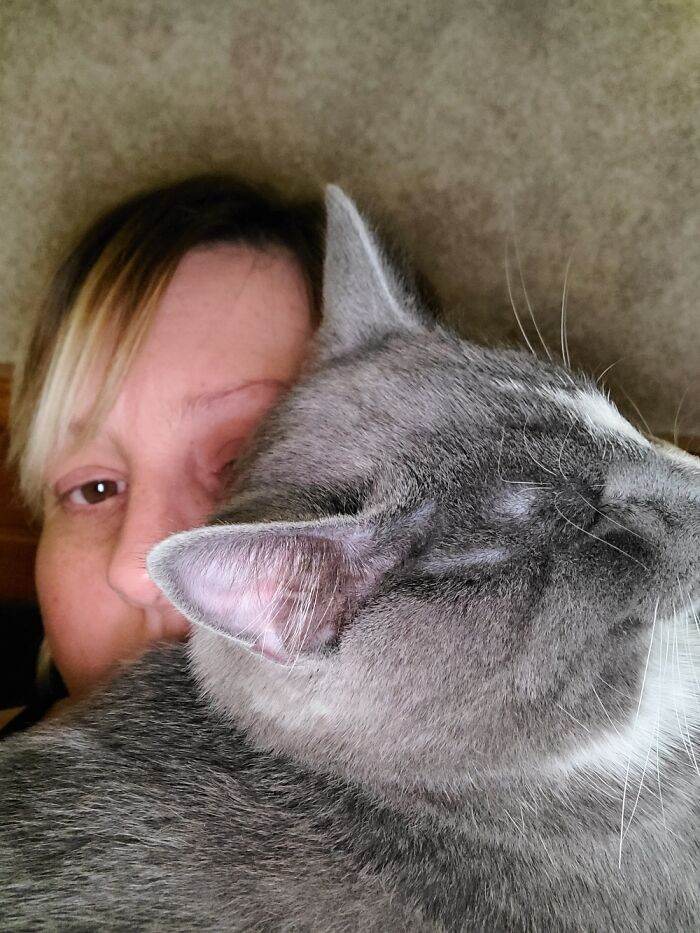 This Is Sterling. Sterling Worries I Might Not See Him And Lays On My Face All The Time.