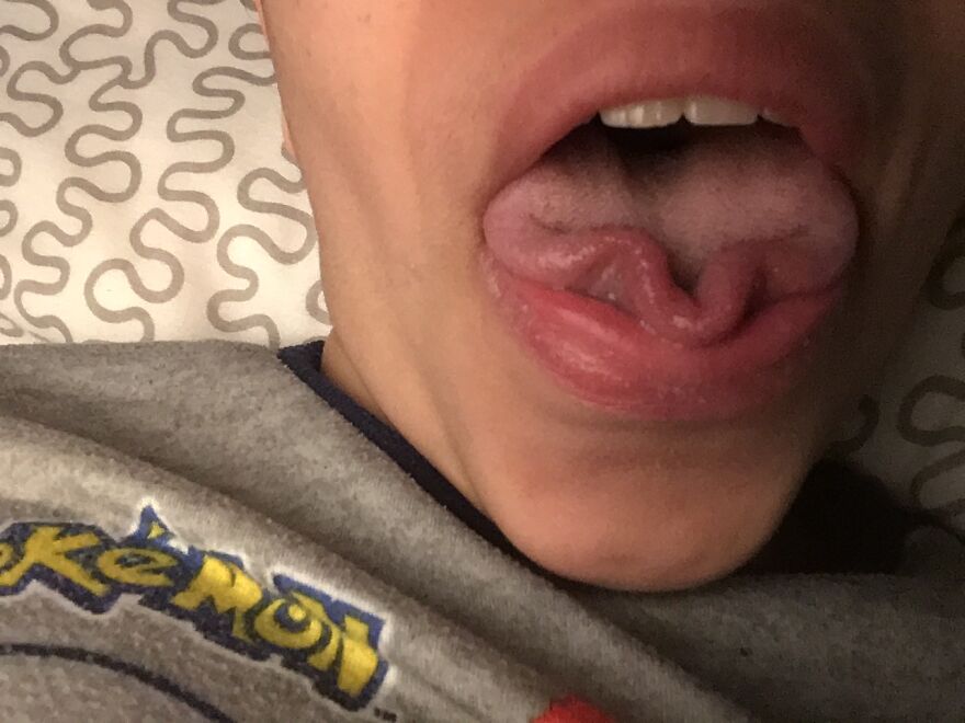 I Call This The Fork Tongue