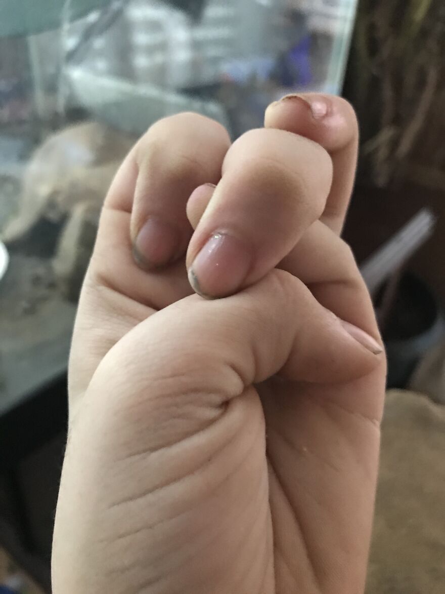 I Can Do The Finger Knot Thing