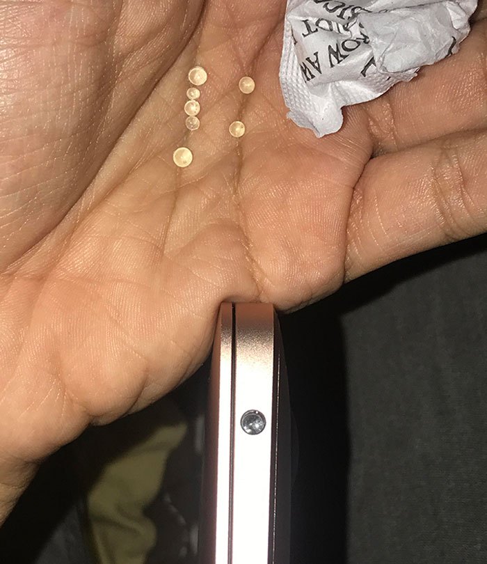 Girlfriend Didn’t Realize The Silica Packet Was In Her Laptop Bag And Was Ripped. Perfect Size To Get Stuck In Her MacBook Aux