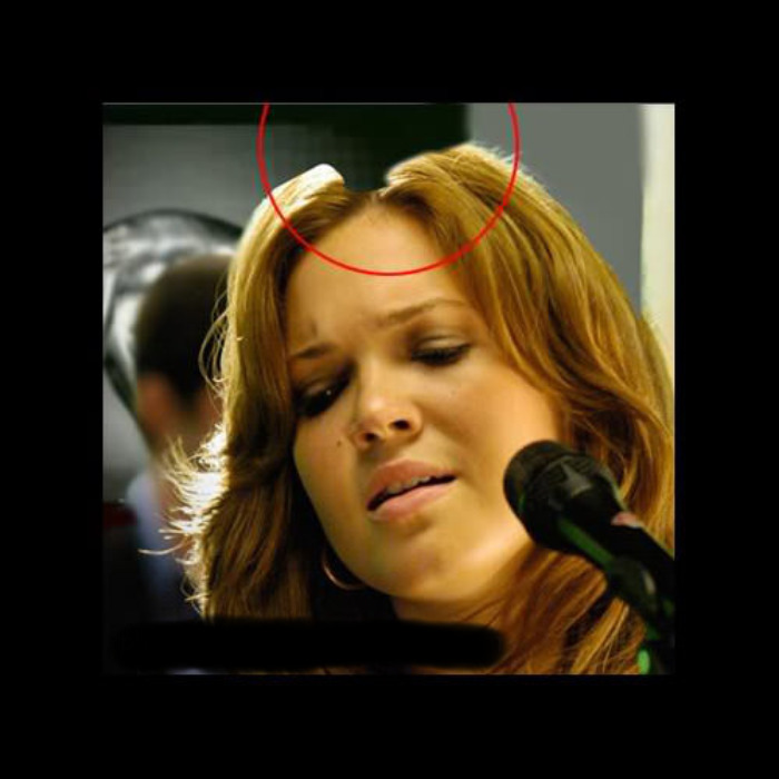 Bad Hairline. Guess You Could Say Highway Head.