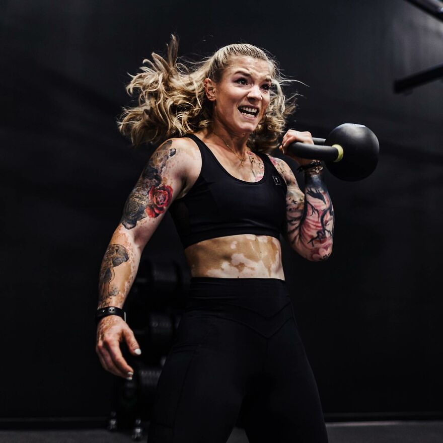 This Woman From Utah Learned To Accept Her Vitiligo Through Fitness And Weightlifting This Woman From Utah Learned To Accept Her Vitiligo Through Fitness And Weightlifting