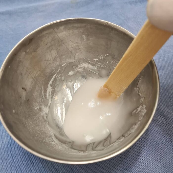 Parrot Gets A Brand New Beak After Being Rescued In A Horrible Condition