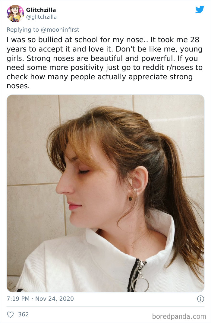 Women-Noses-Look-Like-Before-Photos