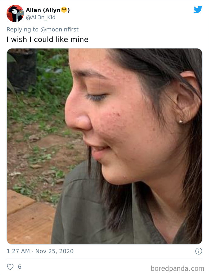 Women-Noses-Look-Like-Before-Photos