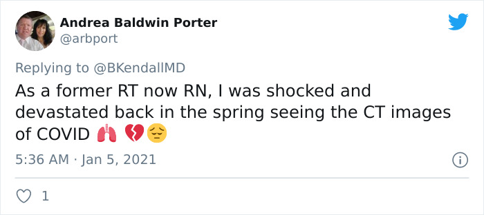 X-Ray Shows The Effect Of COVID-19 On The Lungs Compared To A Smoker's Lungs X-Ray Shows The Effect Of COVID-19 On The Lungs Compared To A Smoker's Lungs