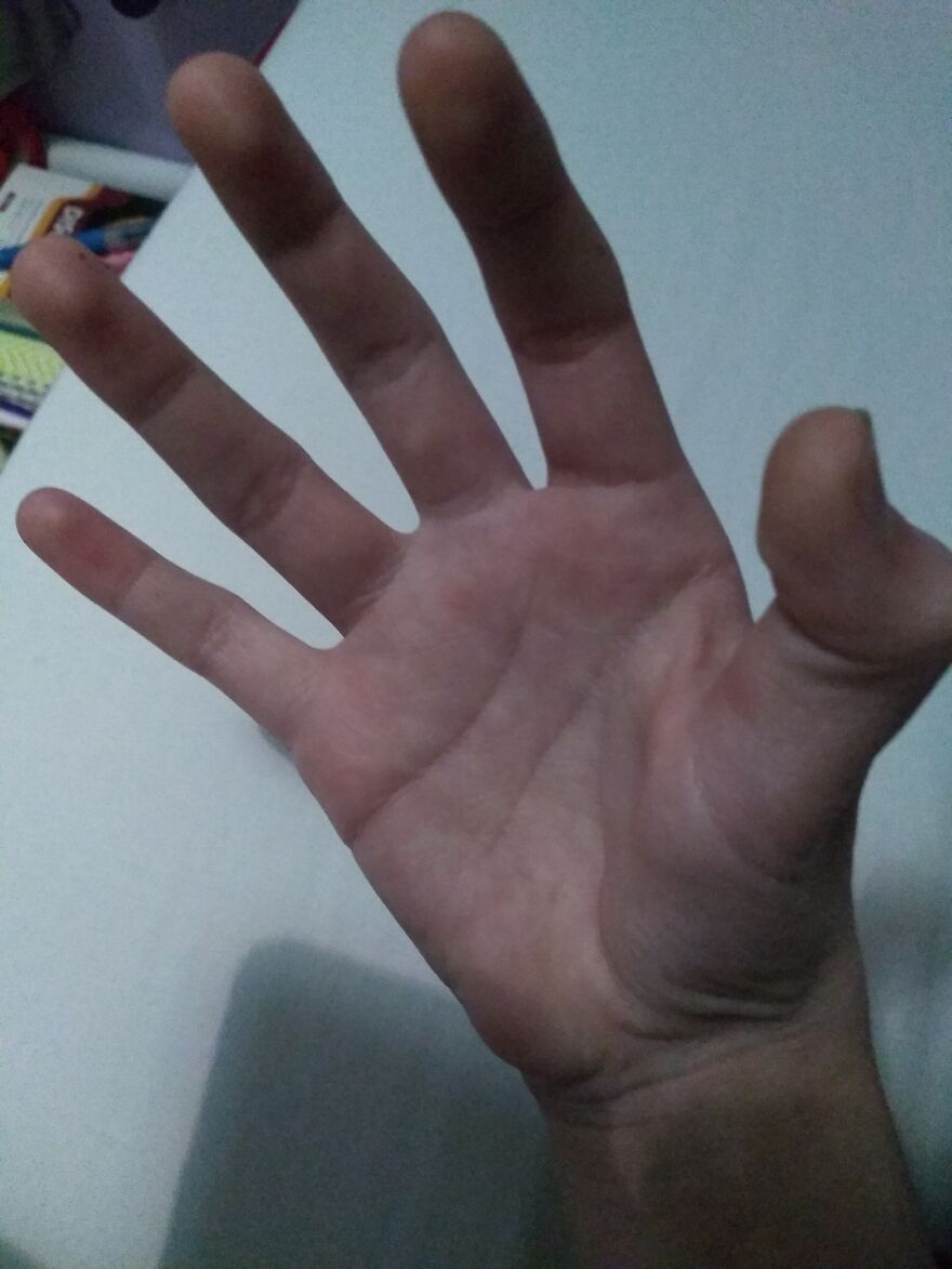 I Can Do This (It Doesn't Really Look Like I'm Doing Anything But I Am Dislocating My Thumb I Promise)