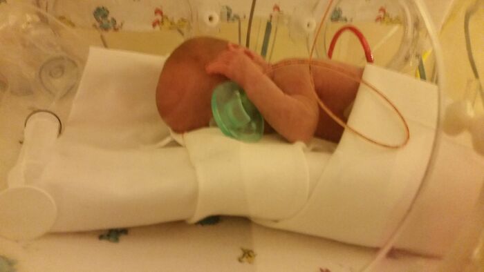 My Daughter When She Was A Month Old In The Nicu. Despite How Small She Looks Her Daddy And I Considered Her Big When The Picture Was Taken. She's Now A Normal Happy 3 Year Old.