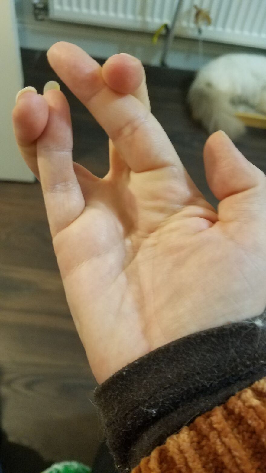 I Can Cross Both Pairs Of Fingers Simultaneously, And On Both Hands At The Same Time