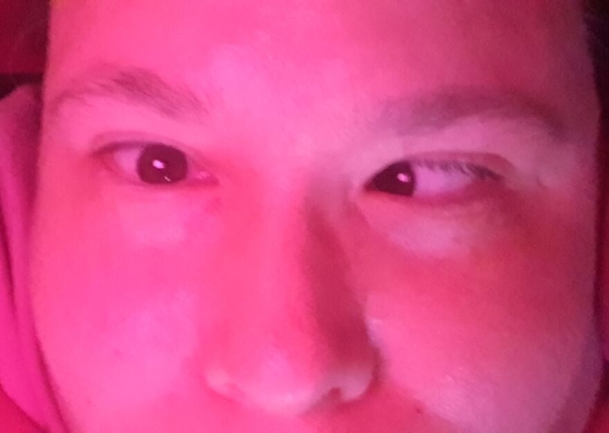 I Can Roll My Eyes Separetely.