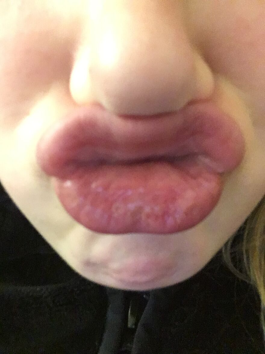 I Can Plug My Nose With My Lip