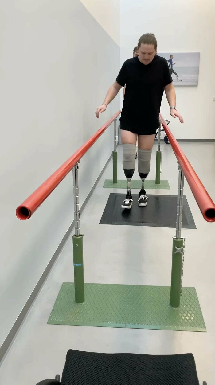 I Am Incredibly Proud Of My Progress Over The Last Five And A Half Months. The First Part Shows My First Steps With My New Legs, The Second Part Is From A Few Weeks Ago. Practice, Determination And Support From Friends And Family Got Me Here