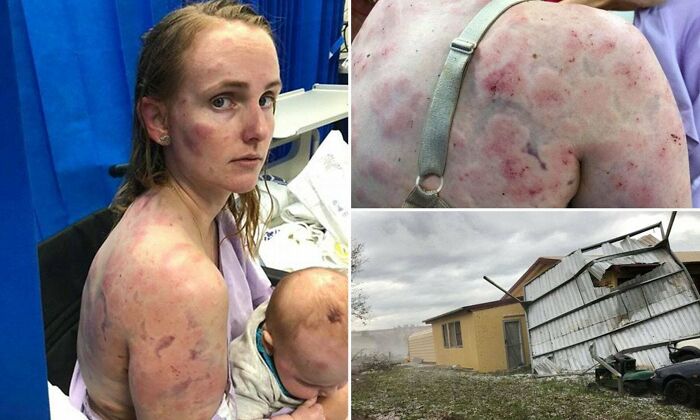 When You Have To Protect Your Baby From A Hail Storm