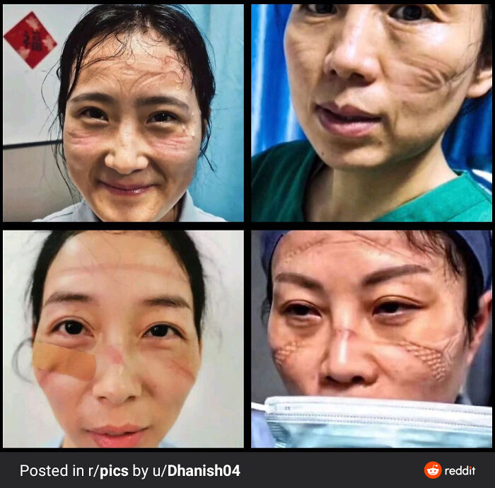 Wuhan Doctors Working Continuously For 12 Hours