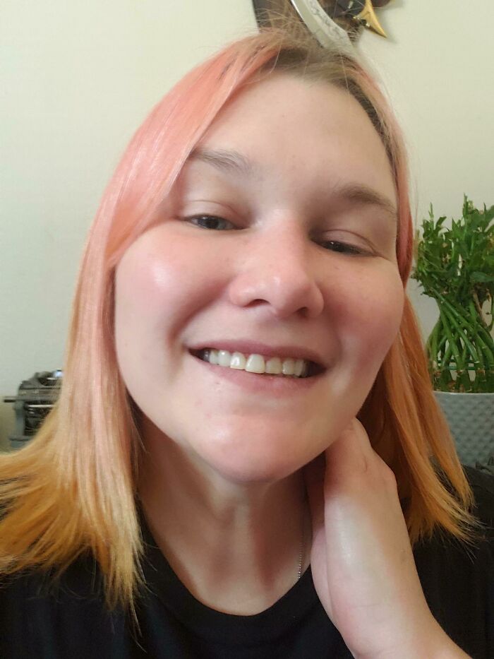 After Years Of Broken Teeth I Could Pay To Get Them Fixed After 5 Visits In June. I Can Smile Again