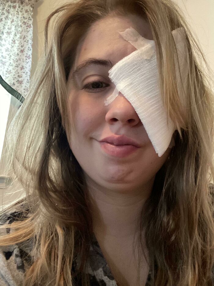 My Son Stuck His Finger In My Eye And Scratched Off The Whole Top Layer Of My Cornea