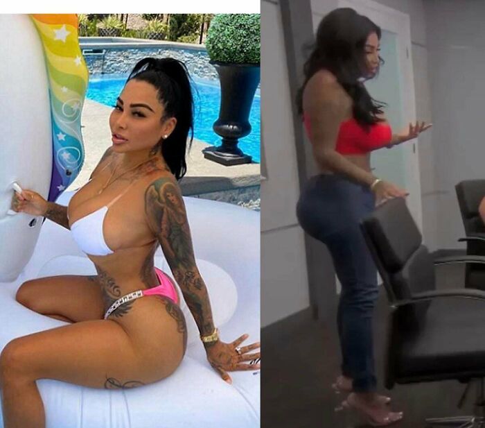 Instagram vs. Her On Botched