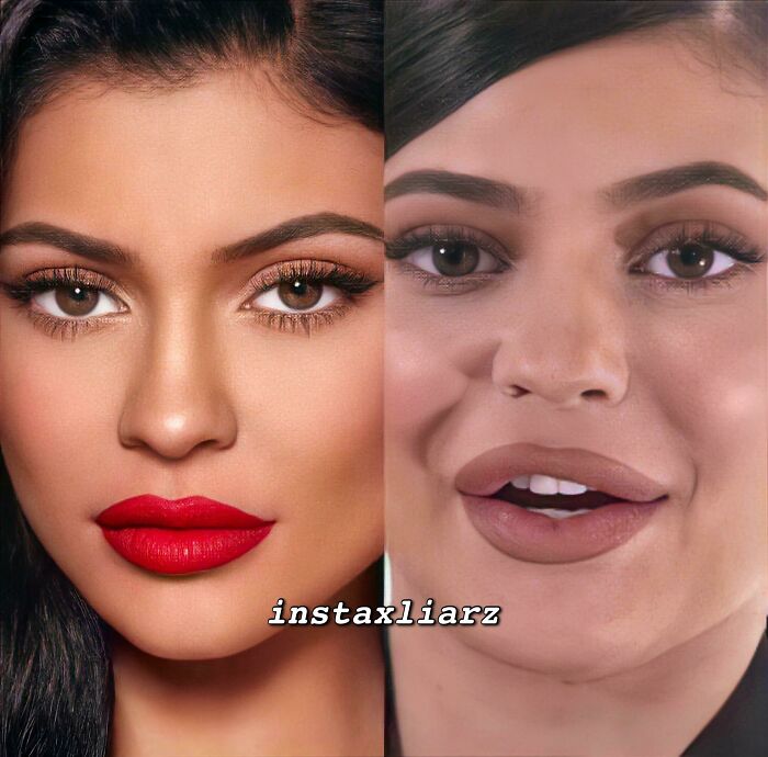 Way Too Much Fillers...