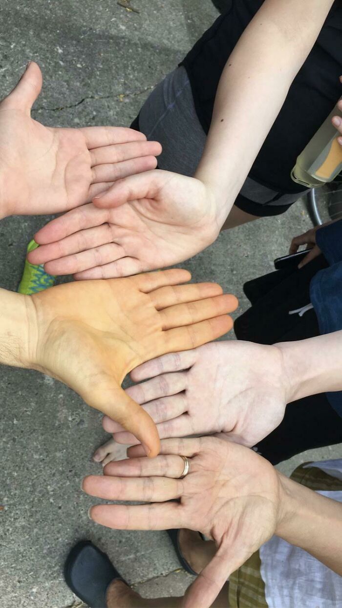 My Dad Eats One Full Carrot In His Veggie Smoothie Everyday. His Skin Compared To Ours