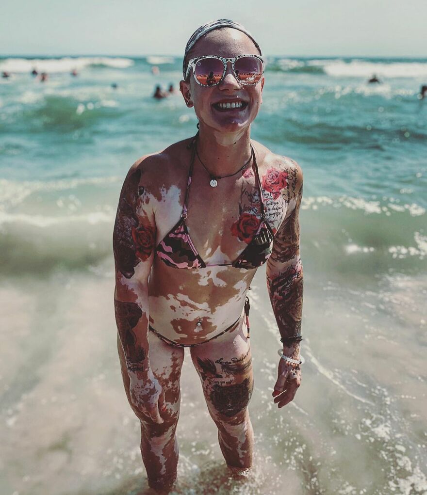 This Woman From Utah Learned To Accept Her Vitiligo Through Fitness And Weightlifting This Woman From Utah Learned To Accept Her Vitiligo Through Fitness And Weightlifting