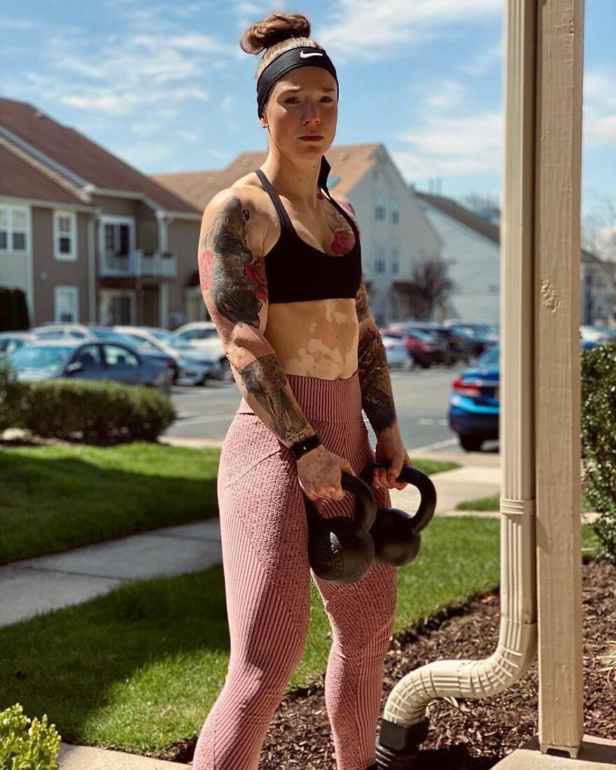 This Woman From Utah Learned To Accept Her Vitiligo Through Fitness And Weightlifting This Woman From Utah Learned To Accept Her Vitiligo Through Fitness And Weightlifting
