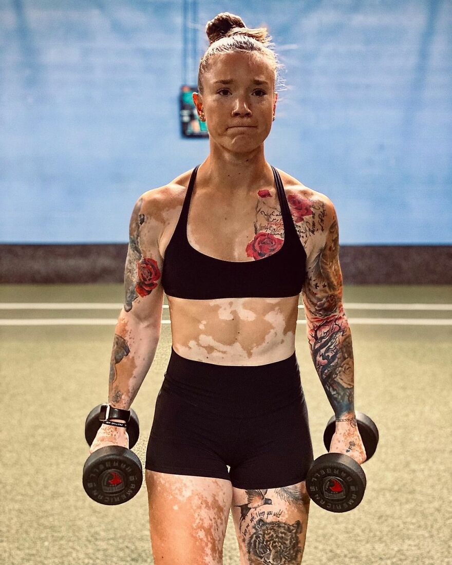 This Woman From Utah Learned To Accept Her Vitiligo Through Fitness And Weightlifting This Woman From Utah Learned To Accept Her Vitiligo Through Fitness And Weightlifting