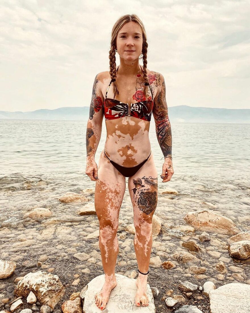 This Woman From Utah Learned To Accept Her Vitiligo Through Fitness And Weightlifting This Woman From Utah Learned To Accept Her Vitiligo Through Fitness And Weightlifting