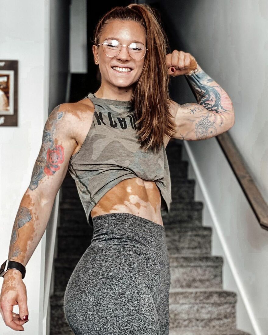 This Woman From Utah Learned To Accept Her Vitiligo Through Fitness And Weightlifting This Woman From Utah Learned To Accept Her Vitiligo Through Fitness And Weightlifting