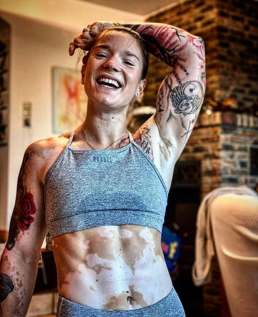 This Woman From Utah Learned To Accept Her Vitiligo Through Fitness And Weightlifting This Woman From Utah Learned To Accept Her Vitiligo Through Fitness And Weightlifting