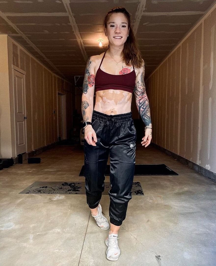 This Woman From Utah Learned To Accept Her Vitiligo Through Fitness And Weightlifting This Woman From Utah Learned To Accept Her Vitiligo Through Fitness And Weightlifting