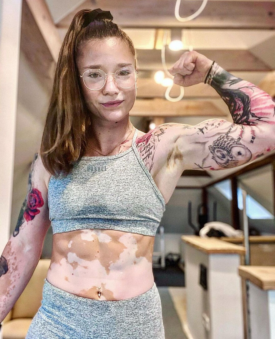 This Woman From Utah Learned To Accept Her Vitiligo Through Fitness And Weightlifting This Woman From Utah Learned To Accept Her Vitiligo Through Fitness And Weightlifting