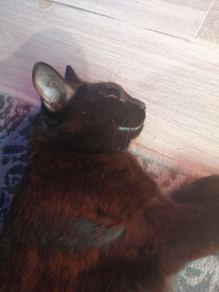 Ronnie Has A Life Long Eye Condition, She Has To Take Steroids Twice A Day. But Even In This Crappy Time, She Is Happy