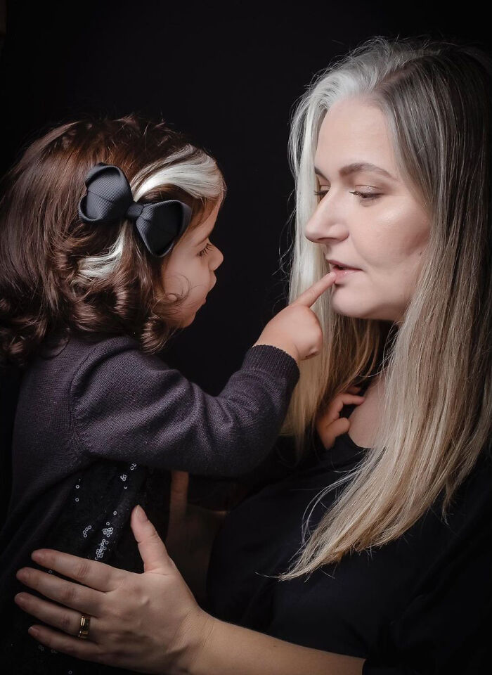 Mother Encourages Her Two-year-old Who Was Born With A White Streak In Her Hair To Embrace Her Uniqueness