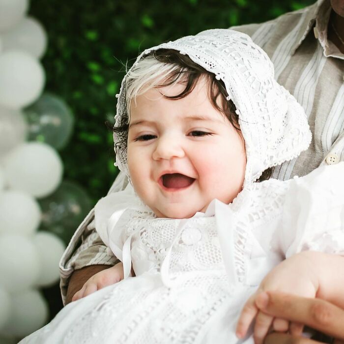 Mother Encourages Her Two-year-old Who Was Born With A White Streak In Her Hair To Embrace Her Uniqueness