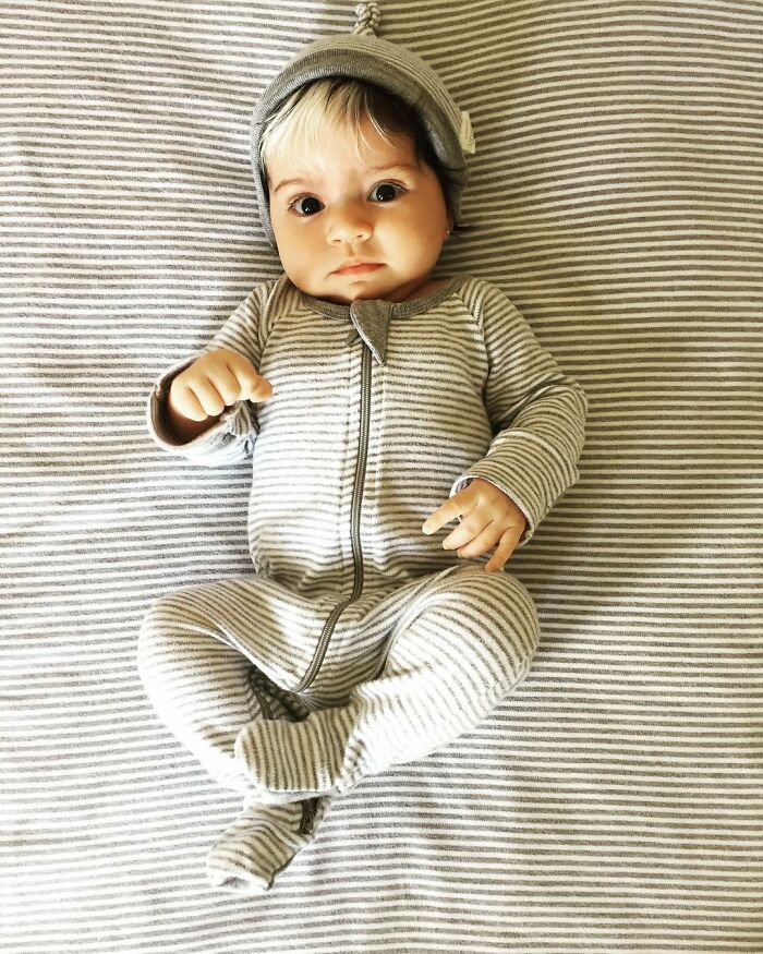 Mother Encourages Her Two-year-old Who Was Born With A White Streak In Her Hair To Embrace Her Uniqueness