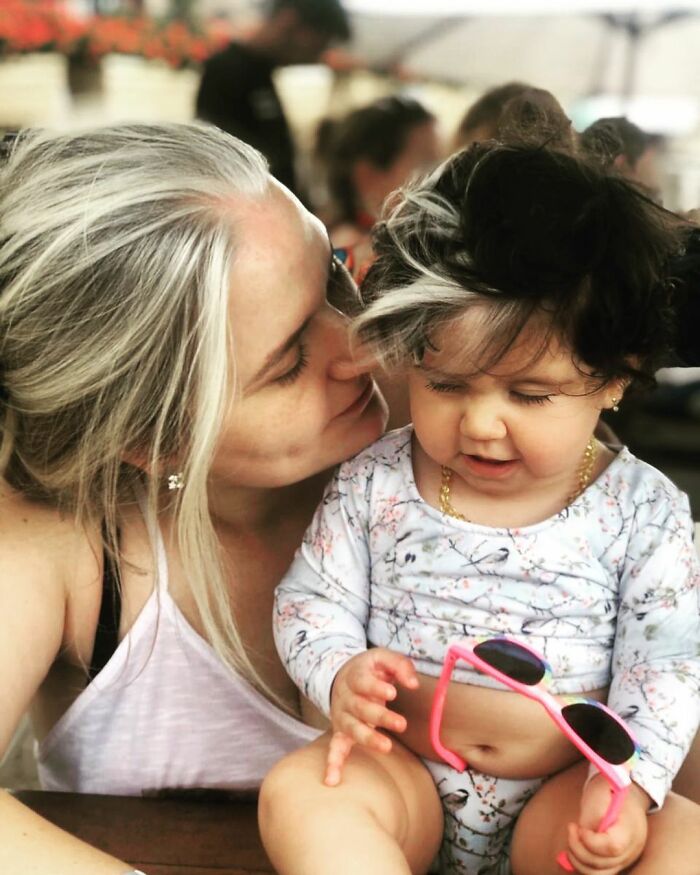 Mother Encourages Her Two-year-old Who Was Born With A White Streak In Her Hair To Embrace Her Uniqueness