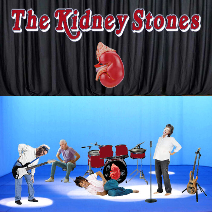 'the Kidney Stones'