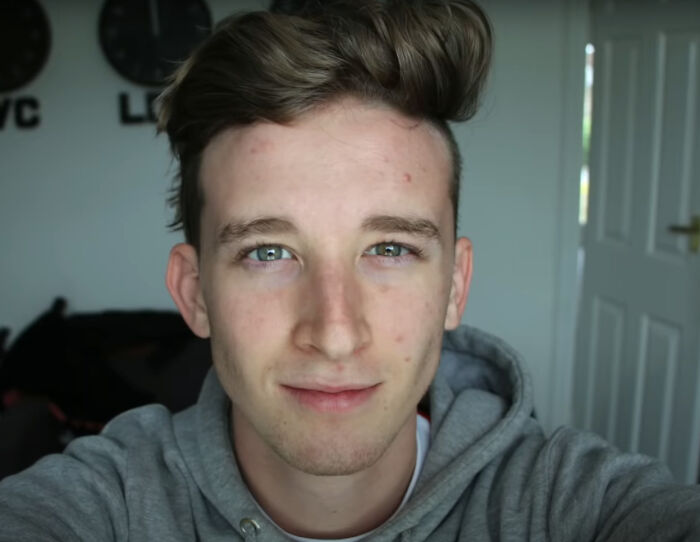 Guy Takes Selfies Every Day For 10 Years, Shows How Subtle Changes Create A Big Difference At The End