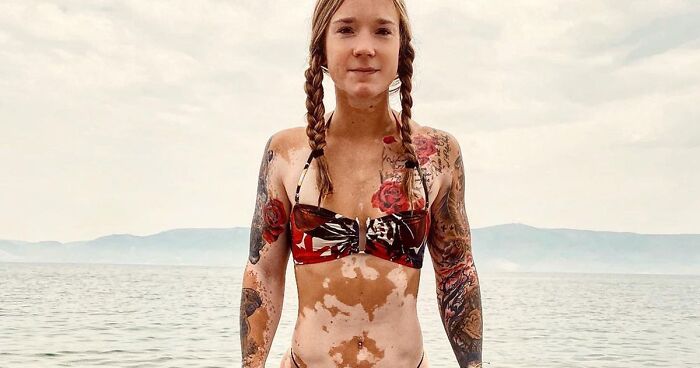 This Woman From Utah Learned To Accept Her Vitiligo Through Fitness And Weightlifting