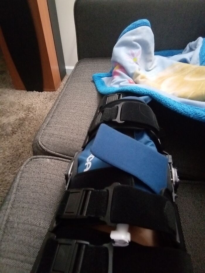 Finally Got My Leg Fixed After Three Years Of Not Being Able To Walk!