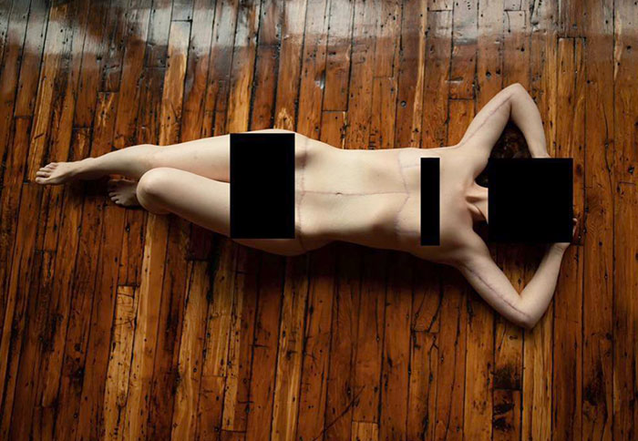 I Lost 170 Lbs, Then Had 9lbs Of Excess Skin Removed. My Scars Make Me Look Like An Irl Sally From The Nightmare Before Christmas