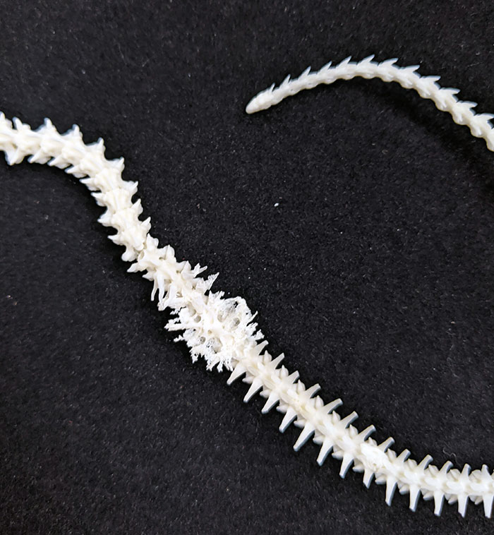 Bone Cancer In A Snake Skeleton