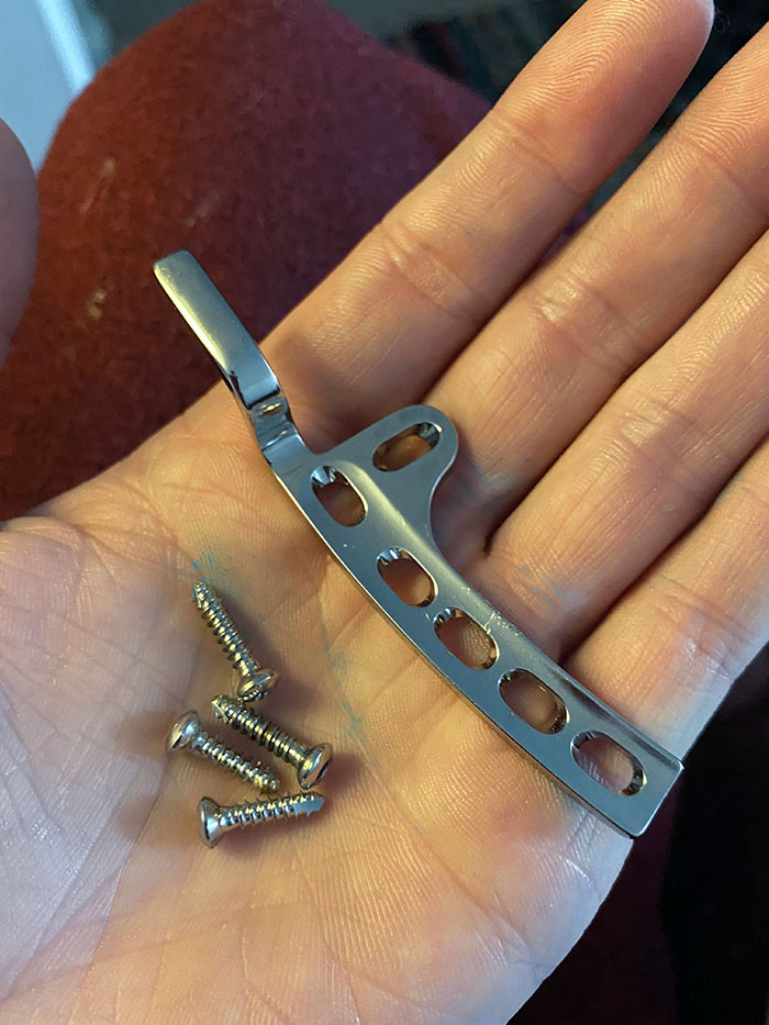 The Surgeon Gave Back To Me The Plate And Screws He Removed From My Clavicle